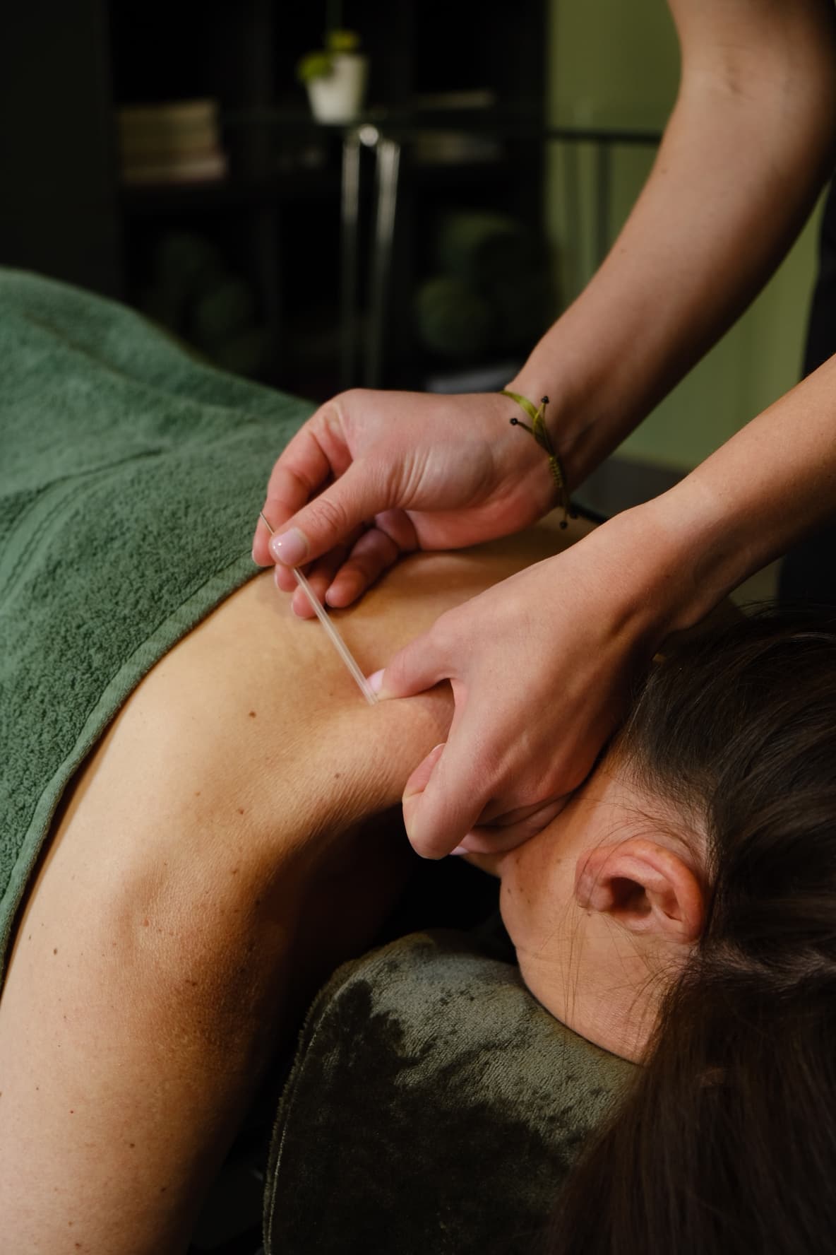 Myofascial Dry Needling treatment